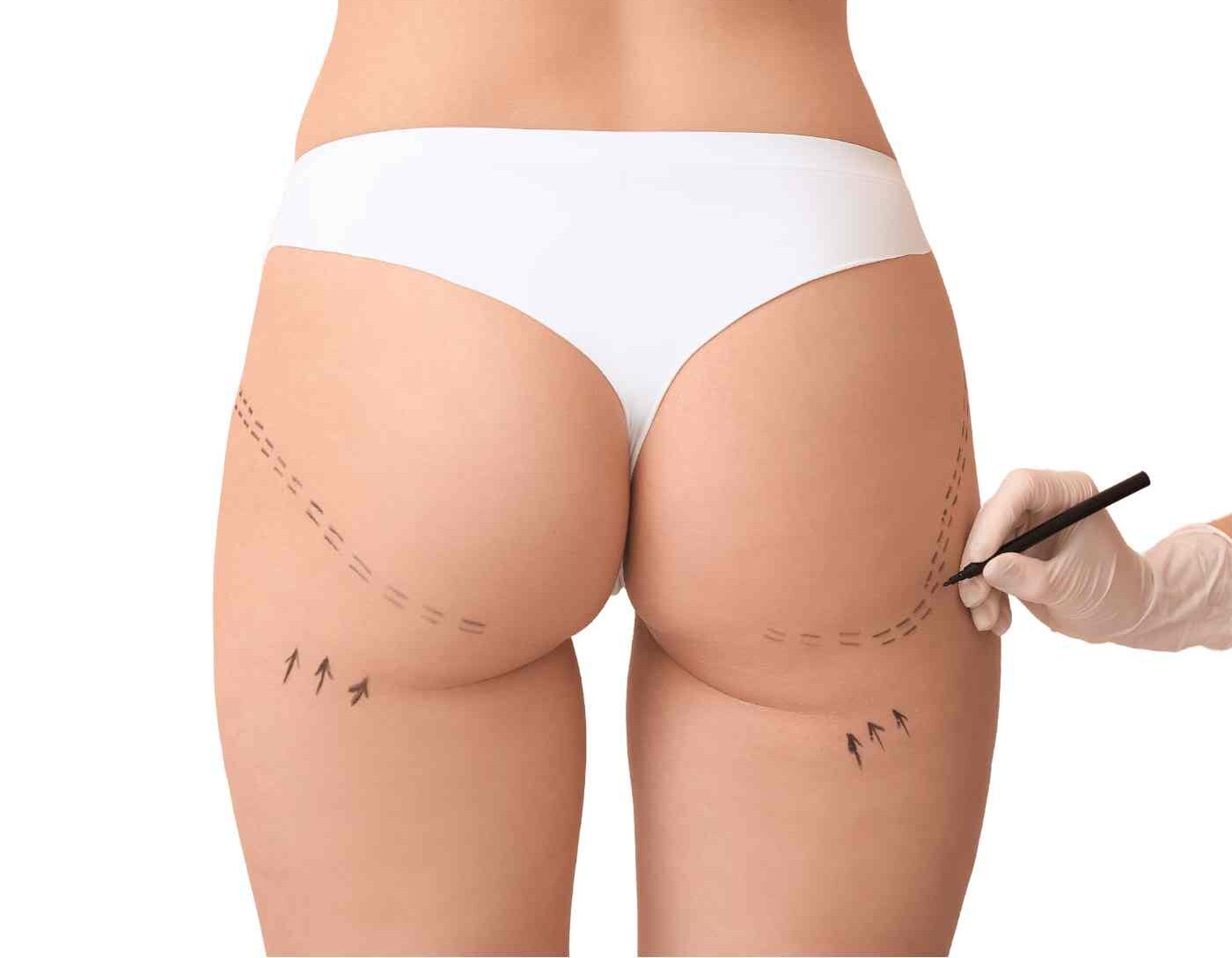Precision plastic surgery equipment