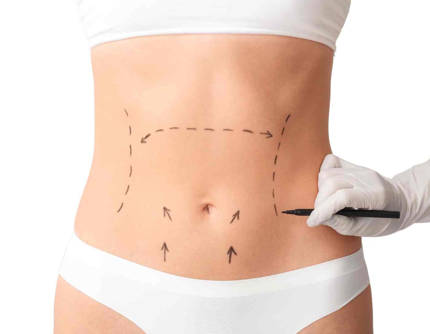 Aesthetic consultation at CER Hospital