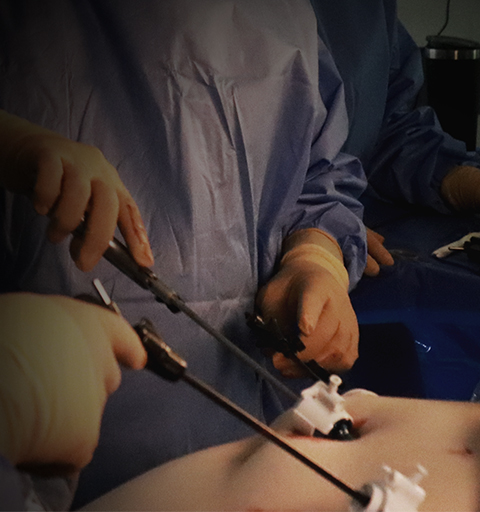 Bariatric Surgery